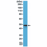 Western Blot - Anti-CD79a Antibody [RM297] (A121479) - Antibodies.com