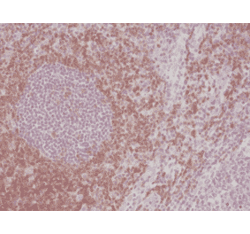 Immunohistochemistry - Anti-CD5 Antibody [RM354] (A121464) - Antibodies.com