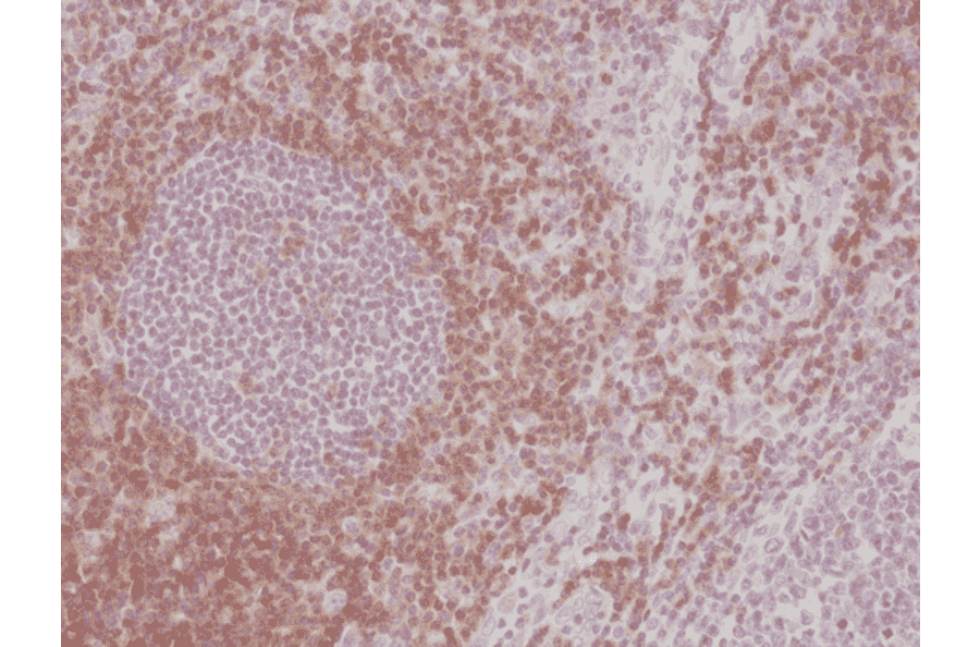 Immunohistochemistry - Anti-CD5 Antibody [RM354] (A121464) - Antibodies.com