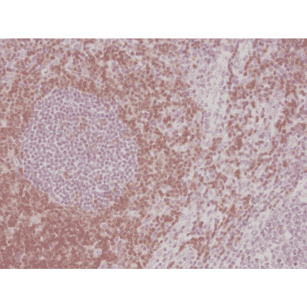 Immunohistochemistry - Anti-CD5 Antibody [RM354] (A121464) - Antibodies.com