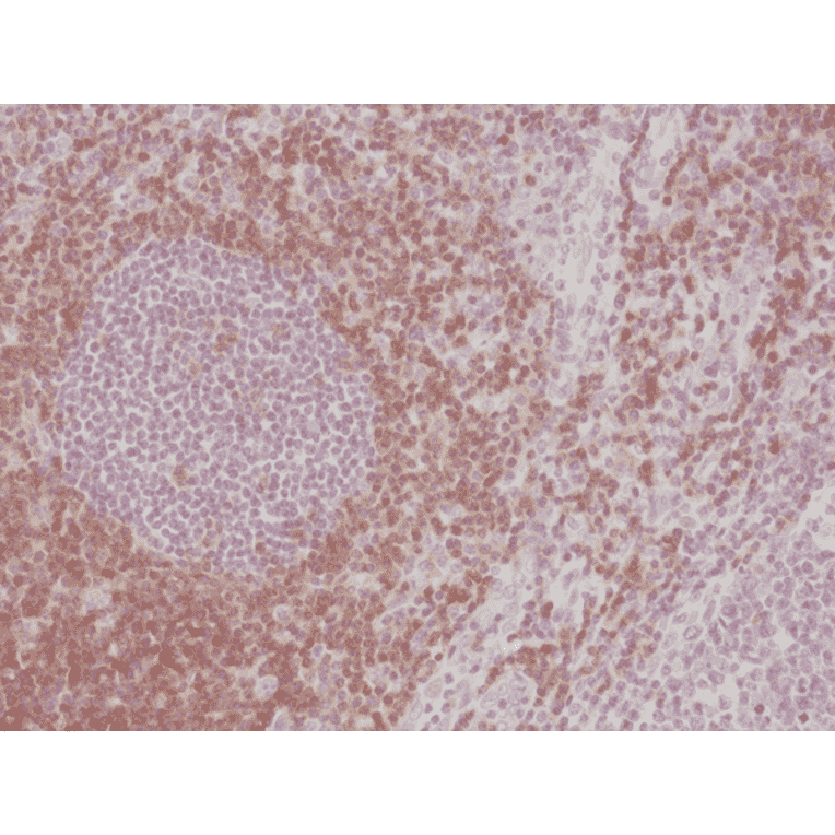 Immunohistochemistry - Anti-CD5 Antibody [RM354] (A121464) - Antibodies.com