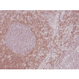 Immunohistochemistry - Anti-CD5 Antibody [RM354] (A121464) - Antibodies.com