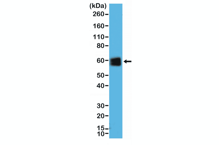 Western Blot - Anti-CD5 Antibody [RM354] (A121480) - Antibodies.com