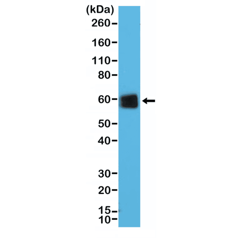 Western Blot - Anti-CD5 Antibody [RM354] (A121480) - Antibodies.com