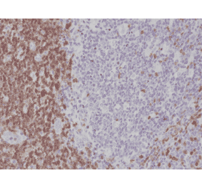 Immunohistochemistry - Anti-CD5 Antibody [RM314] (A121492) - Antibodies.com