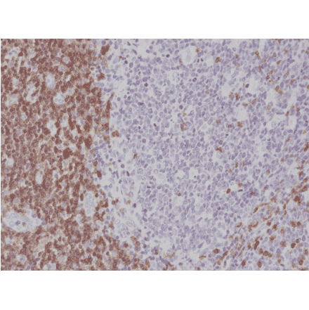 Immunohistochemistry - Anti-CD5 Antibody [RM314] (A121492) - Antibodies.com