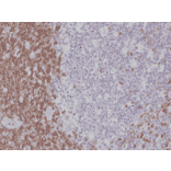 Immunohistochemistry - Anti-CD5 Antibody [RM314] (A121492) - Antibodies.com