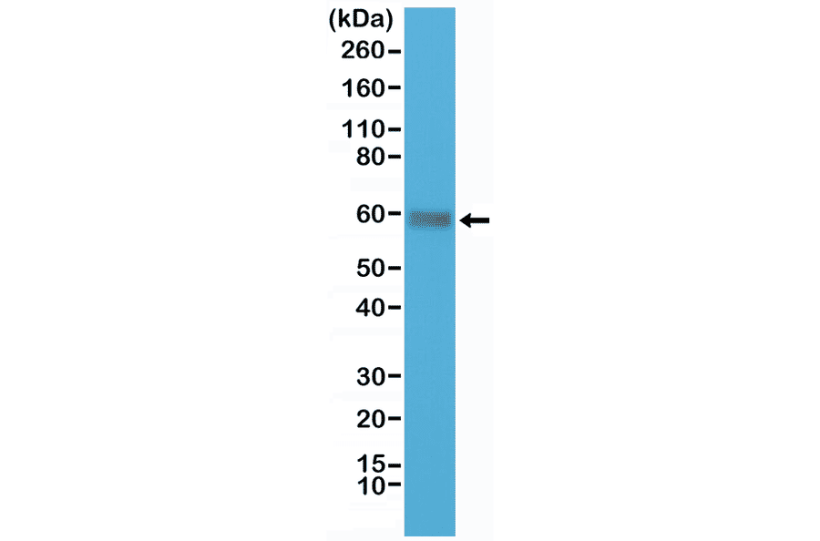 Western Blot - Anti-CD5 Antibody [RM314] (A121481) - Antibodies.com
