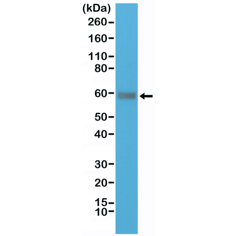 Western Blot - Anti-CD5 Antibody [RM314] (A121481) - Antibodies.com