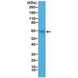 Western Blot - Anti-CD5 Antibody [RM314] (A121481) - Antibodies.com