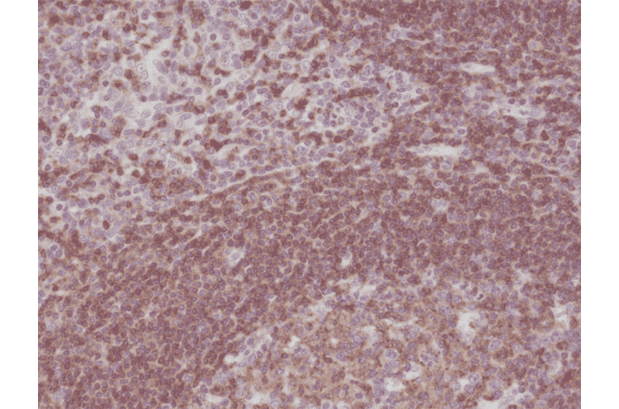 Immunohistochemistry - Anti-CD45 Antibody [RM291] (A121466) - Antibodies.com