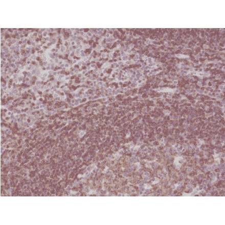 Immunohistochemistry - Anti-CD45 Antibody [RM291] (A121466) - Antibodies.com