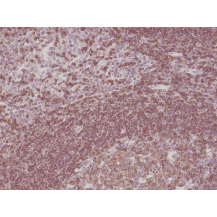 Immunohistochemistry - Anti-CD45 Antibody [RM291] (A121466) - Antibodies.com