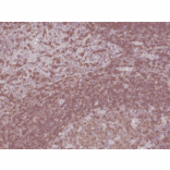 Immunohistochemistry - Anti-CD45 Antibody [RM291] (A121466) - Antibodies.com