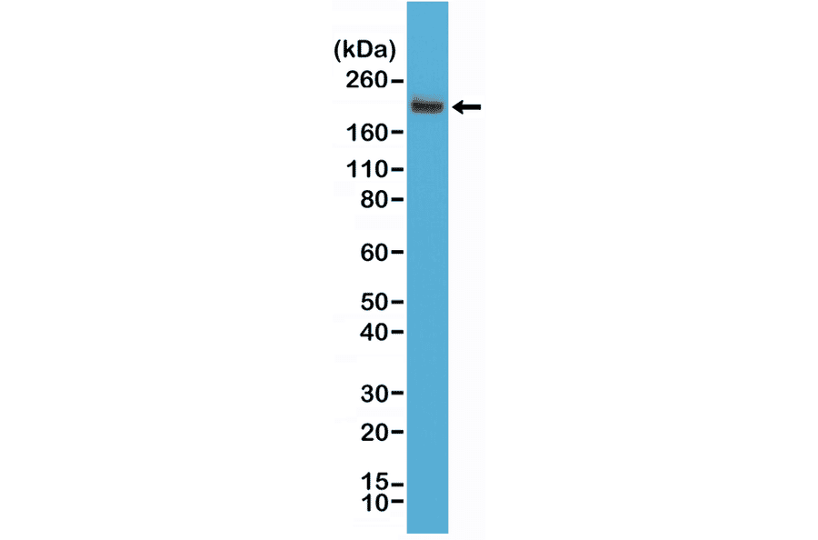 Western Blot - Anti-CD45 Antibody [RM291] (A121482) - Antibodies.com