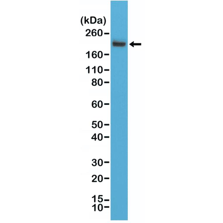 Western Blot - Anti-CD45 Antibody [RM291] (A121482) - Antibodies.com