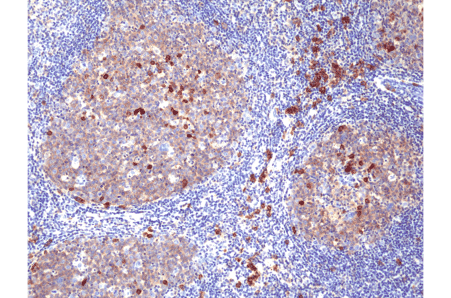 Immunohistochemistry - Anti-CD38 Antibody [RM388] (A121443) - Antibodies.com