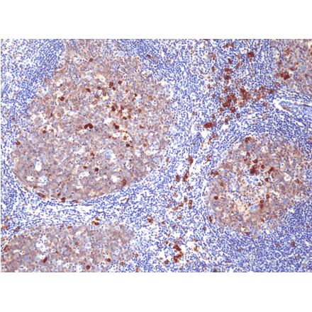 Immunohistochemistry - Anti-CD38 Antibody [RM388] (A121443) - Antibodies.com