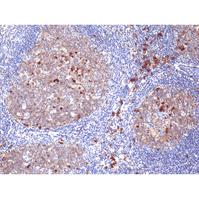 Immunohistochemistry - Anti-CD38 Antibody [RM388] (A121443) - Antibodies.com