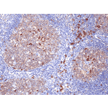 Immunohistochemistry - Anti-CD38 Antibody [RM388] (A121443) - Antibodies.com