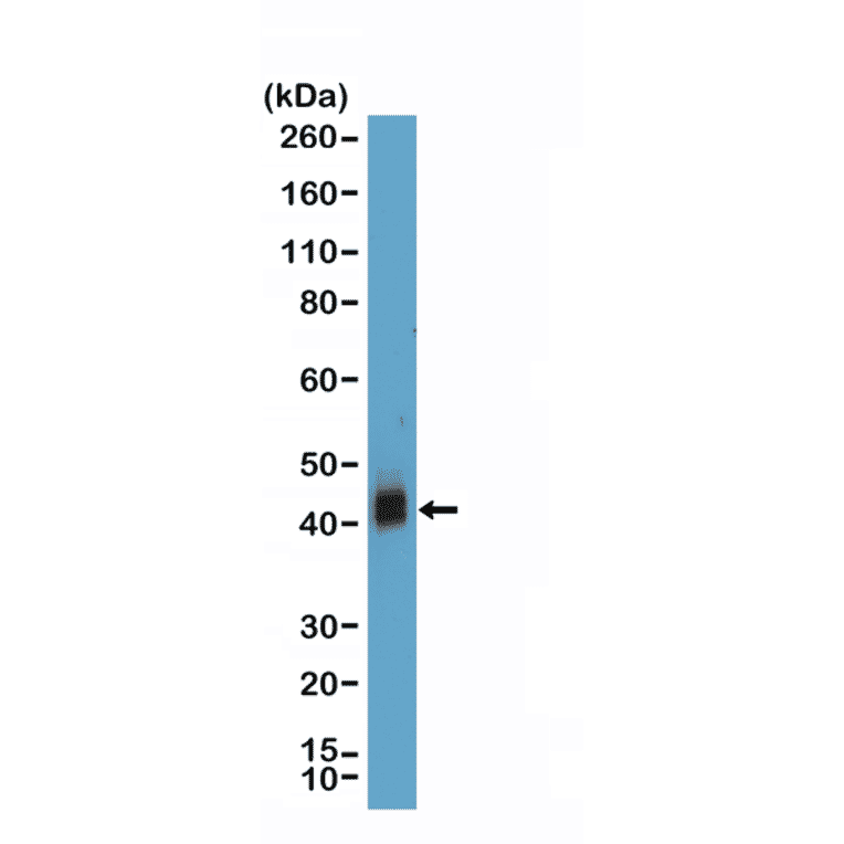 Western Blot - Anti-CD38 Antibody [RM388] (A121483) - Antibodies.com