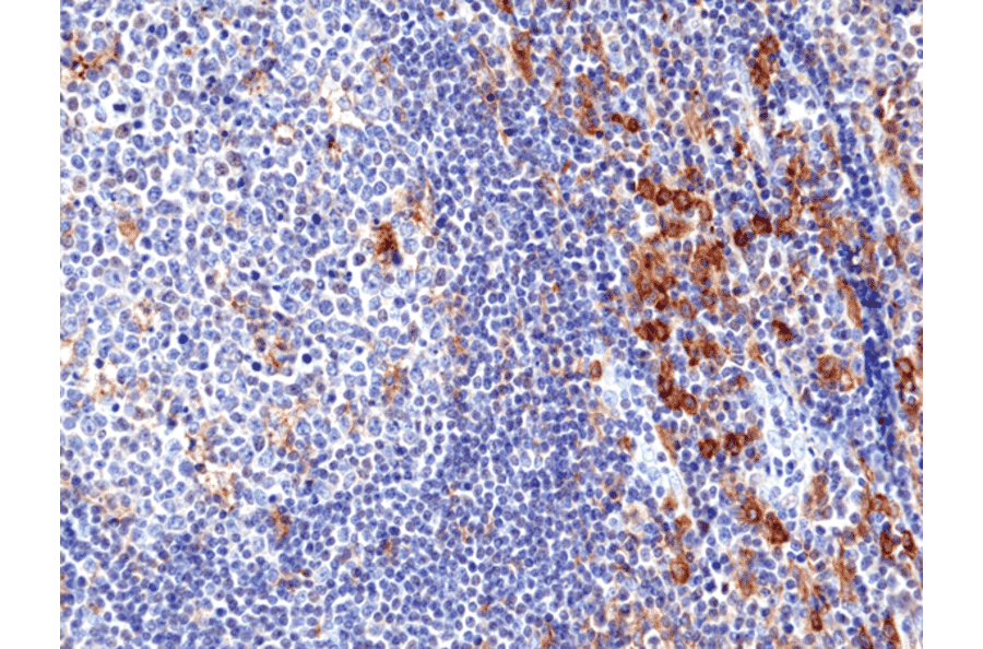 Immunohistochemistry - Anti-CD33 Antibody [RM398] (A121478) - Antibodies.com