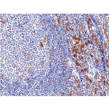 Immunohistochemistry - Anti-CD33 Antibody [RM398] (A121478) - Antibodies.com