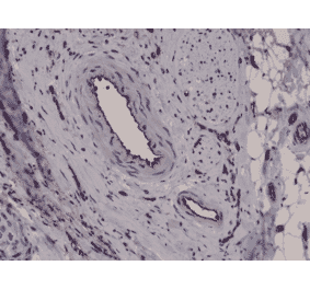 Immunohistochemistry - Anti-CD31 Antibody [RM247] (A121500) - Antibodies.com