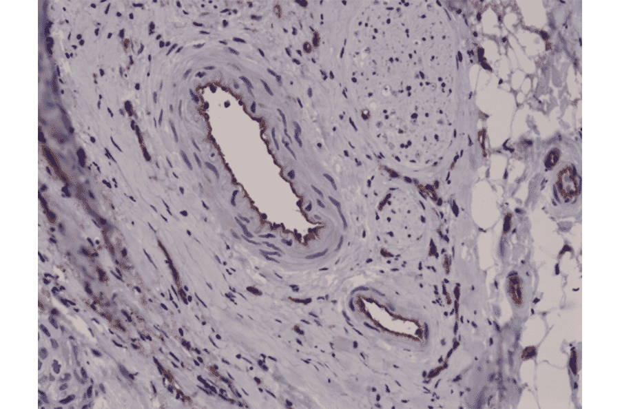 Immunohistochemistry - Anti-CD31 Antibody [RM247] (A121500) - Antibodies.com