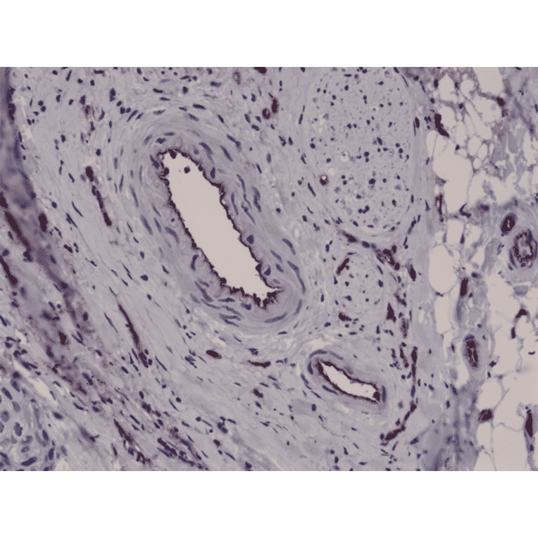 Immunohistochemistry - Anti-CD31 Antibody [RM247] (A121500) - Antibodies.com