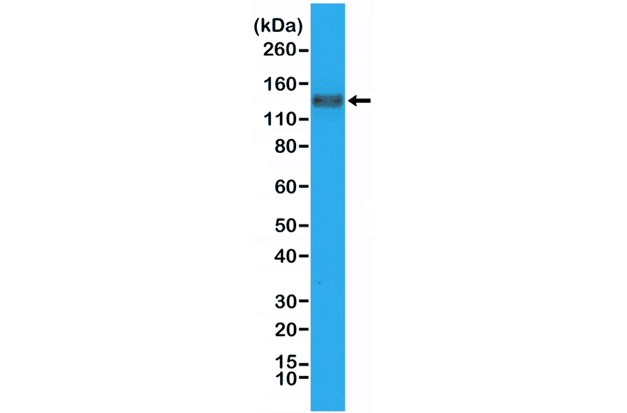 Western Blot - Anti-CD31 Antibody [RM247] (A121485) - Antibodies.com