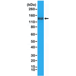 Western Blot - Anti-CD31 Antibody [RM247] (A121485) - Antibodies.com