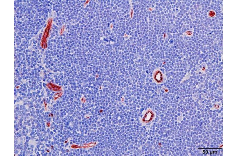 Immunohistochemistry - Anti-CD31 Antibody [RM247] (A121485) - Antibodies.com