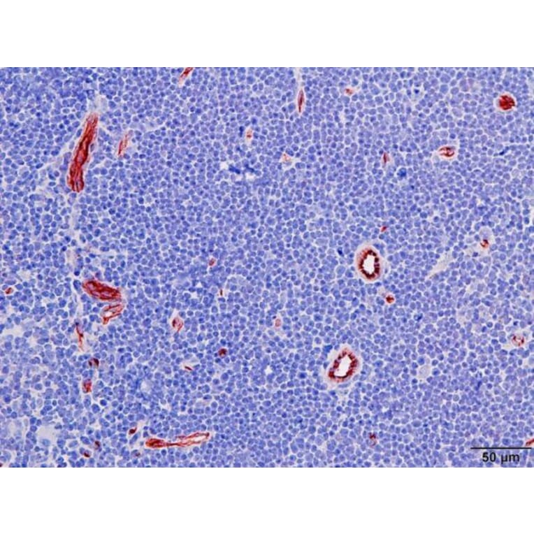 Immunohistochemistry - Anti-CD31 Antibody [RM247] (A121485) - Antibodies.com