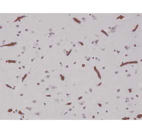 Immunohistochemistry - Anti-CD29 Antibody [RM285] (A121482) - Antibodies.com