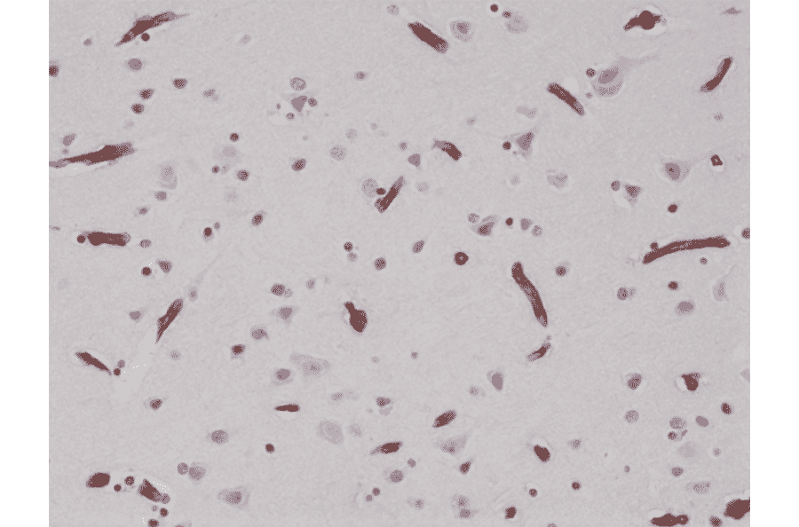Immunohistochemistry - Anti-CD29 Antibody [RM285] (A121482) - Antibodies.com