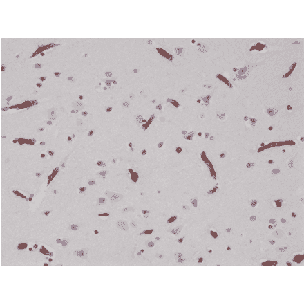 Immunohistochemistry - Anti-CD29 Antibody [RM285] (A121482) - Antibodies.com