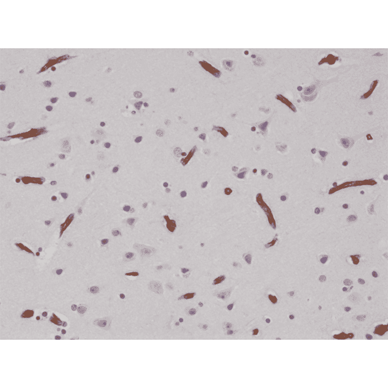 Immunohistochemistry - Anti-CD29 Antibody [RM285] (A121482) - Antibodies.com