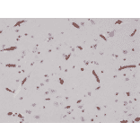 Immunohistochemistry - Anti-CD29 Antibody [RM285] (A121482) - Antibodies.com