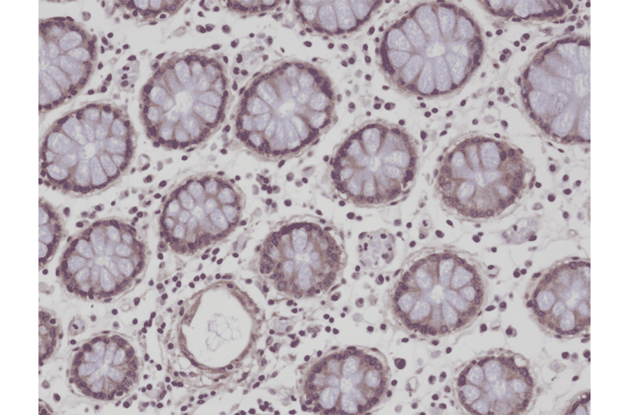 Immunohistochemistry - Anti-CD29 Antibody [RM285] (A121486) - Antibodies.com