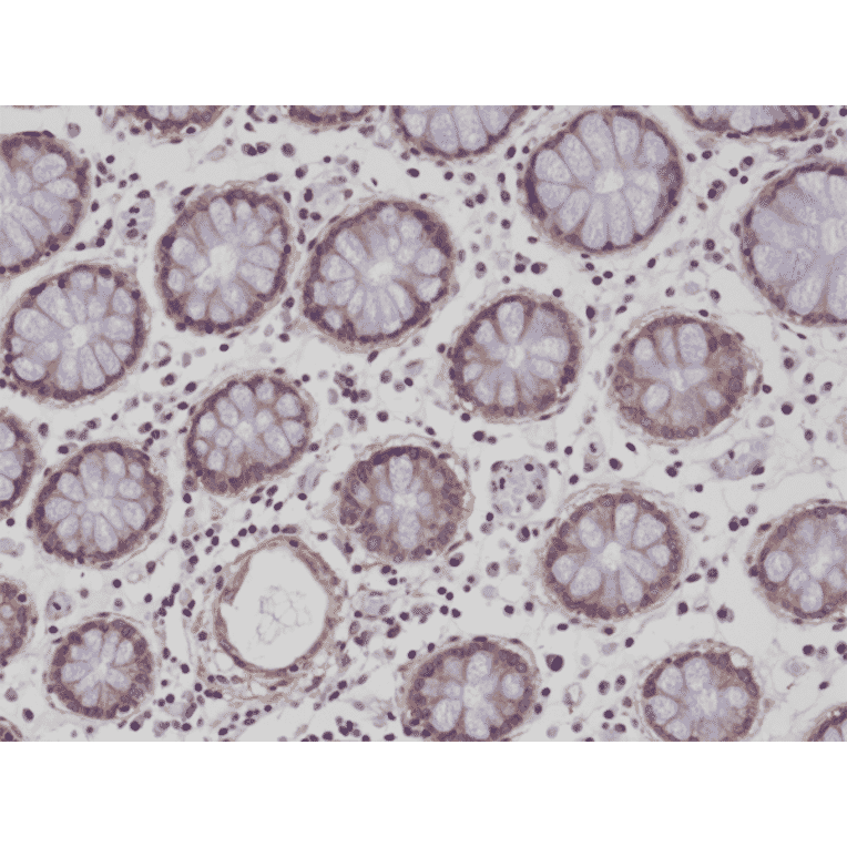 Immunohistochemistry - Anti-CD29 Antibody [RM285] (A121486) - Antibodies.com