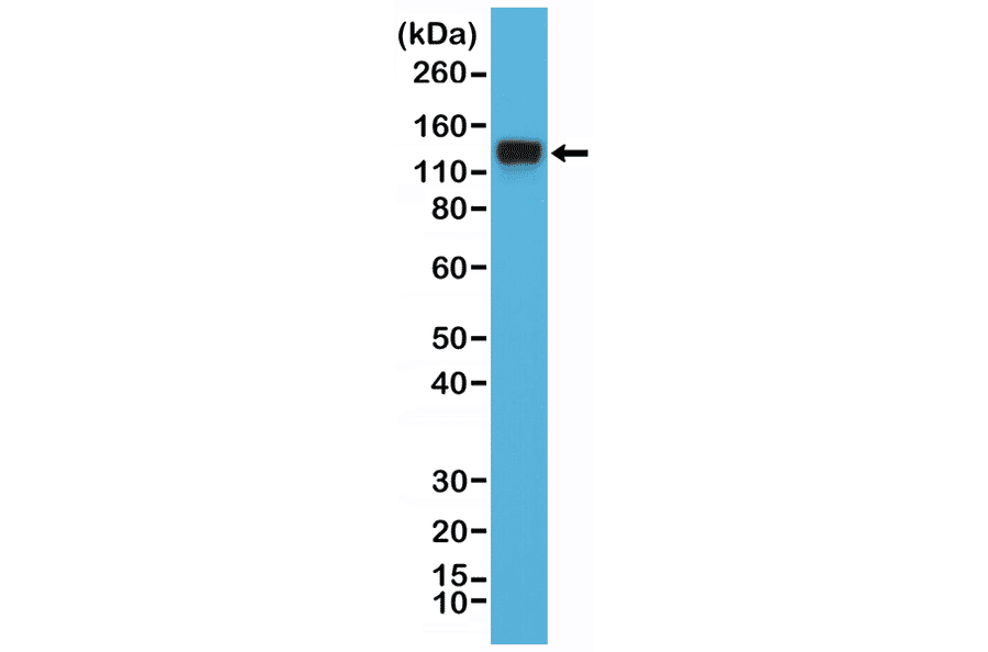 Western Blot - Anti-CD29 Antibody [RM285] (A121486) - Antibodies.com