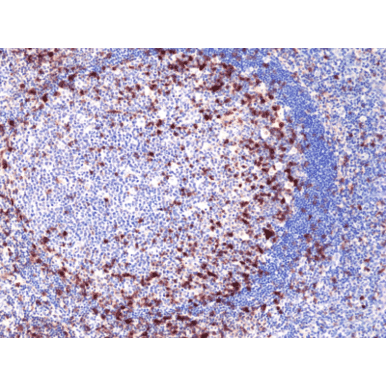 Immunohistochemistry - Anti-CD278 Antibody [RM417] (A121487) - Antibodies.com