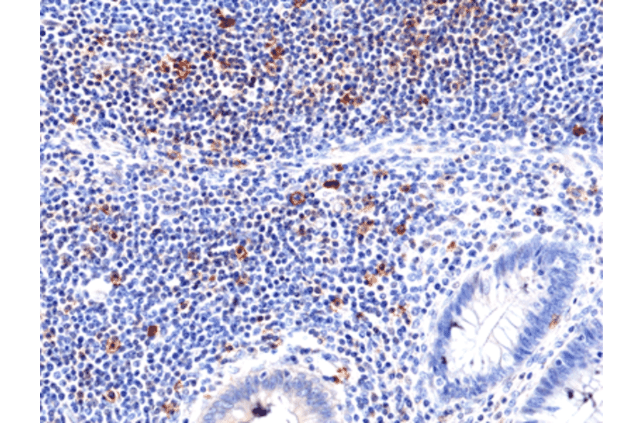 Immunohistochemistry - Anti-CD278 Antibody [RM417] (A121467) - Antibodies.com