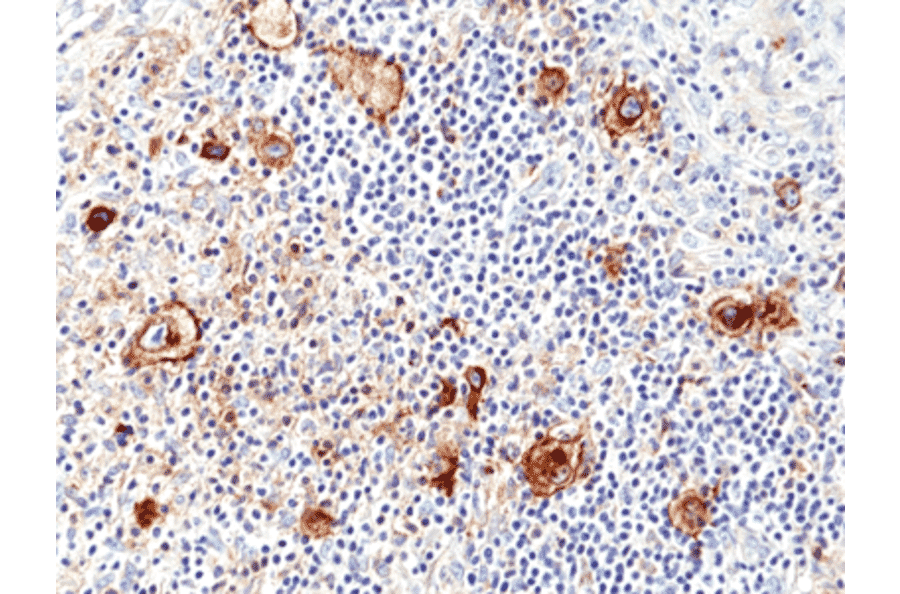 Immunohistochemistry - Anti-CD25 Antibody [RM418] (A121487) - Antibodies.com