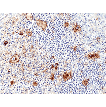 Immunohistochemistry - Anti-CD25 Antibody [RM418] (A121487) - Antibodies.com