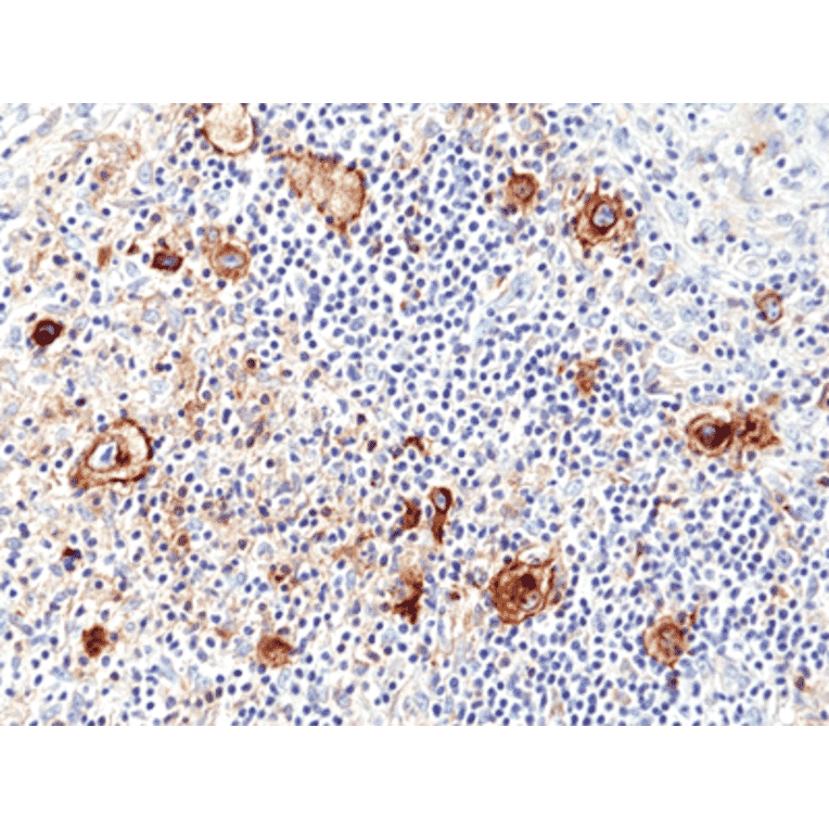 Immunohistochemistry - Anti-CD25 Antibody [RM418] (A121487) - Antibodies.com