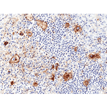Immunohistochemistry - Anti-CD25 Antibody [RM418] (A121487) - Antibodies.com