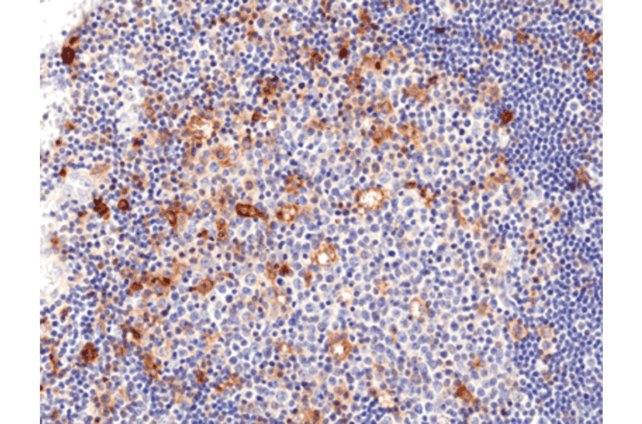 Immunohistochemistry - Anti-CD25 Antibody [RM418] (A121488) - Antibodies.com