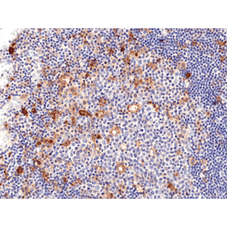 Immunohistochemistry - Anti-CD25 Antibody [RM418] (A121488) - Antibodies.com